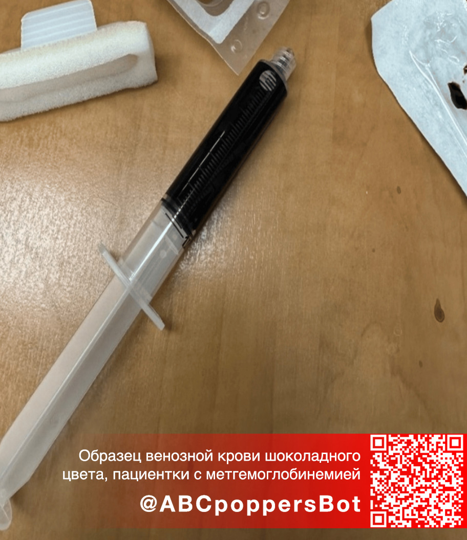 Если принять попперс внутрь в Тамбове это вызывает метгемоглобинемию. Смертельное состояние Если принять попперс внутрь в Тамбове это вызывает метгемоглобинемию. Смертельное состояние